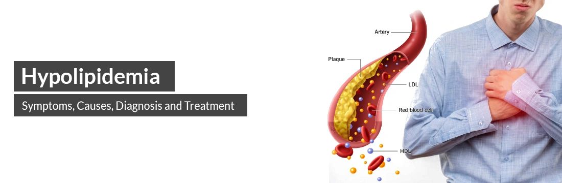 Hypolipidemia: Symptoms, Causes, Diagnosis and Treatment